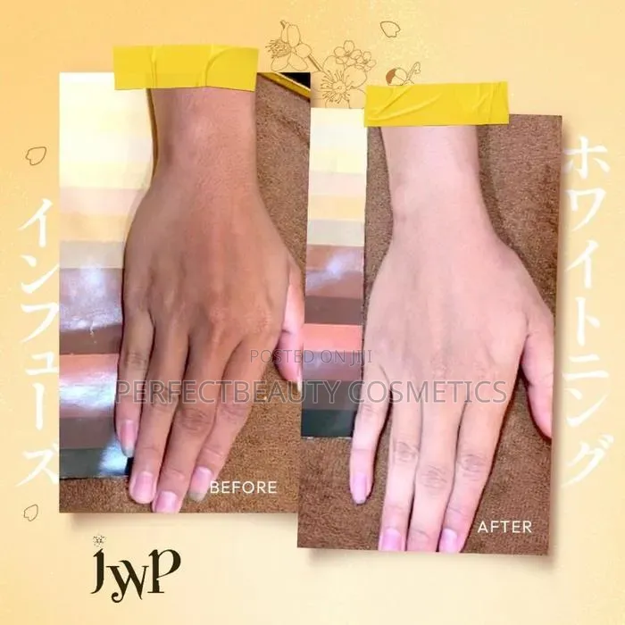Japan Whitening Platinum Gen II