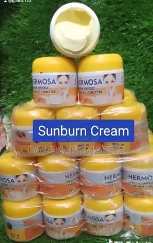 Hermosa Sunburn Cream