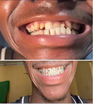Dental Services in Benin City