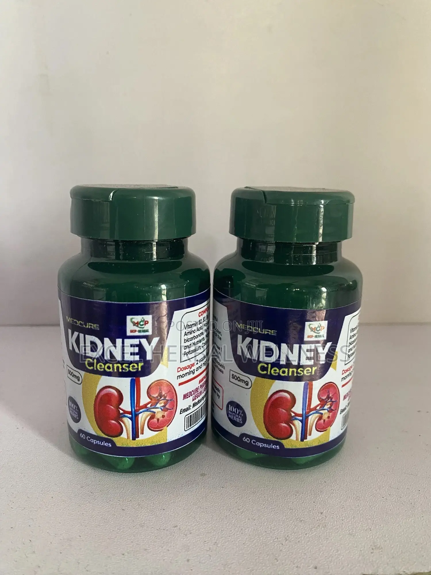 Kidney Stones ( Kidney Disease)