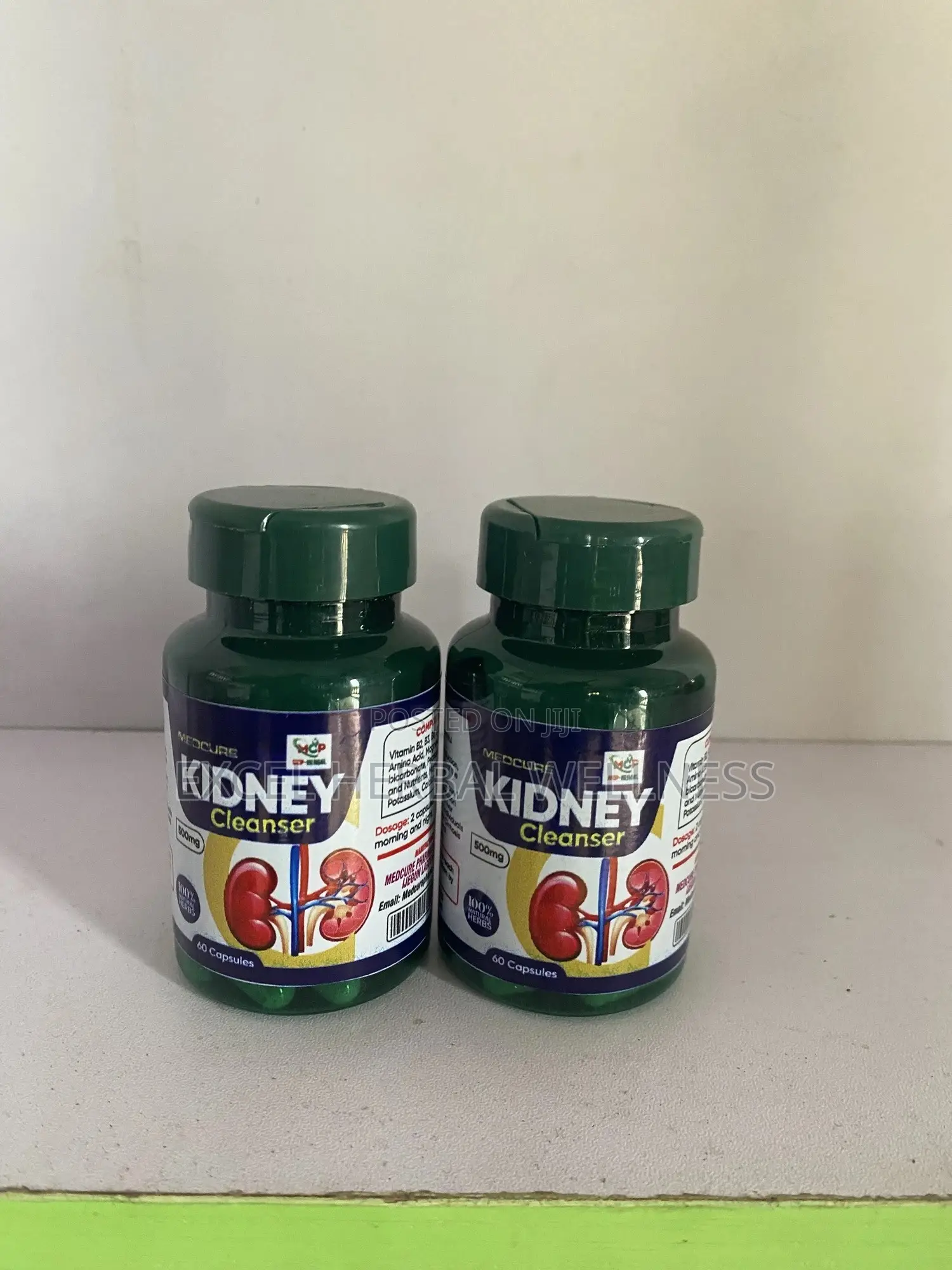 Kidney Stones ( Kidney Disease)