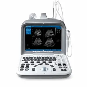 Zoncare I50 Full Digital B-Mode Ultrasound System