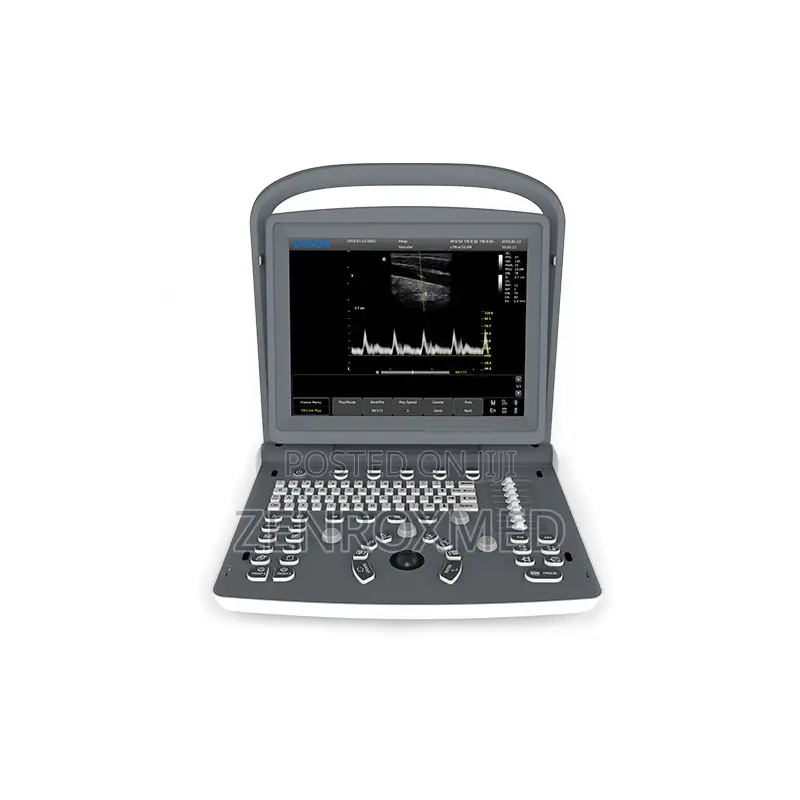 Chison Portable B/W Ultrasound EC02 With Convex Probe