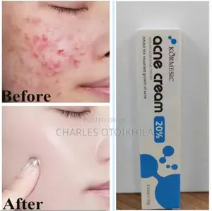 KORMESIC Korean FACE REPAIR Pimples Acne Removal Cream Blemish Control