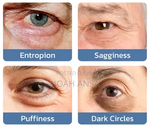 OoenEye Gel