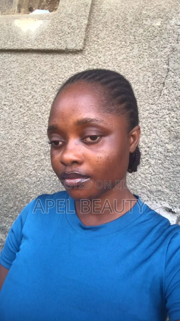 Hyperpigmentation Treatment