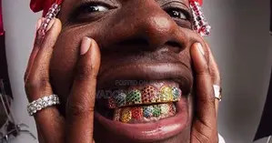 Lil Yachty Colourful Grillz