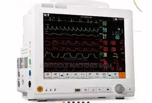 Monitor/ External Defibrillator (AED)