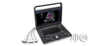 Sonoscape E3 Ultrasound