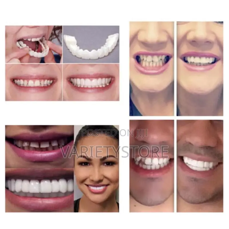 Snap-on Smile Fake Teeth Denture Braces - 2 PCS