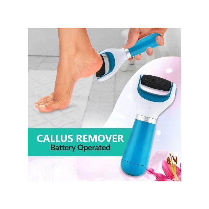 Ped Egg Cordless Callus Remover