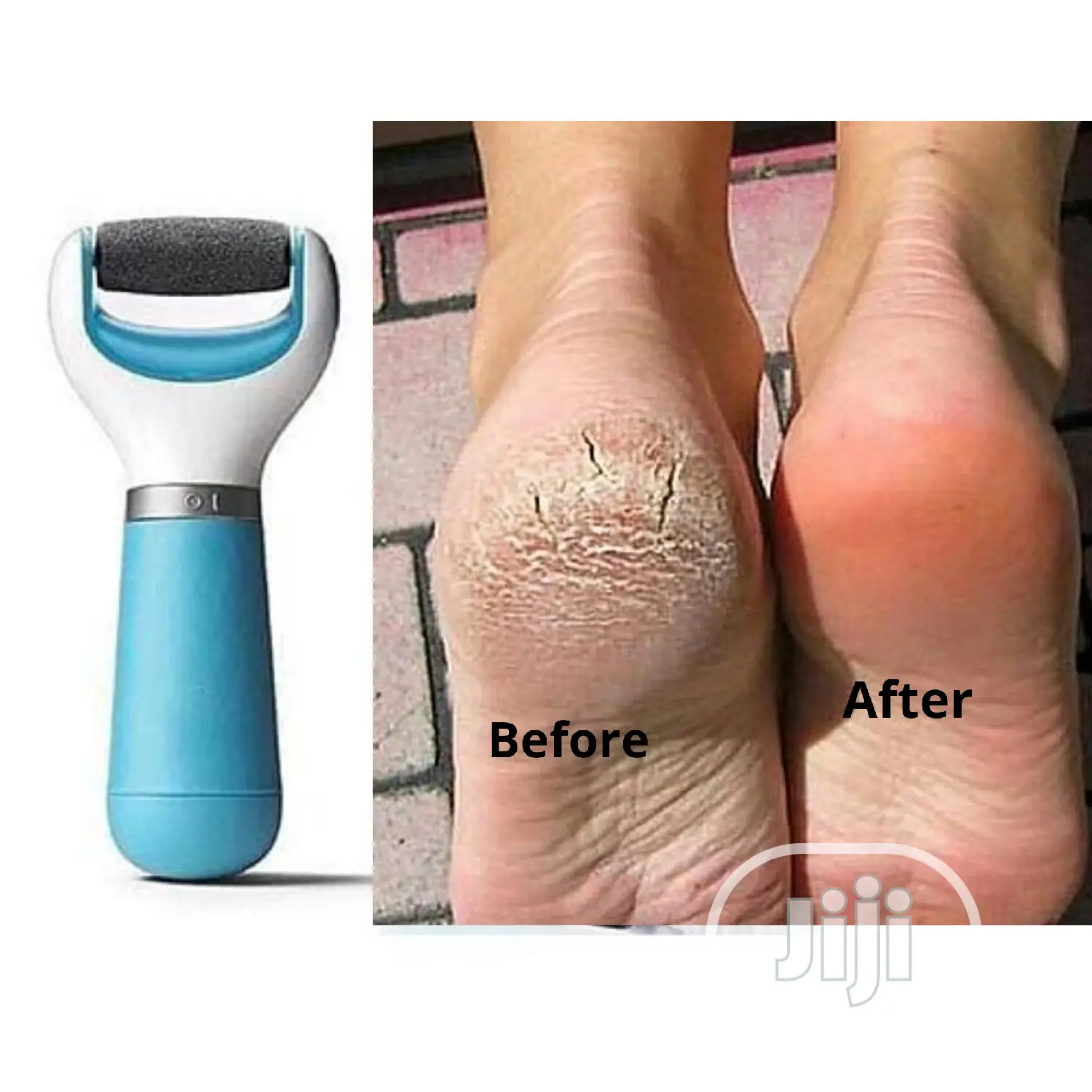 Cordless Electric Callus Remover