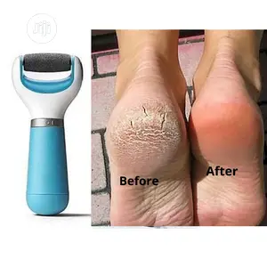 Cordless Electric Callus Remover