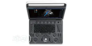 Sonoscape E2 - Ultrasound Machines(2 Probes)