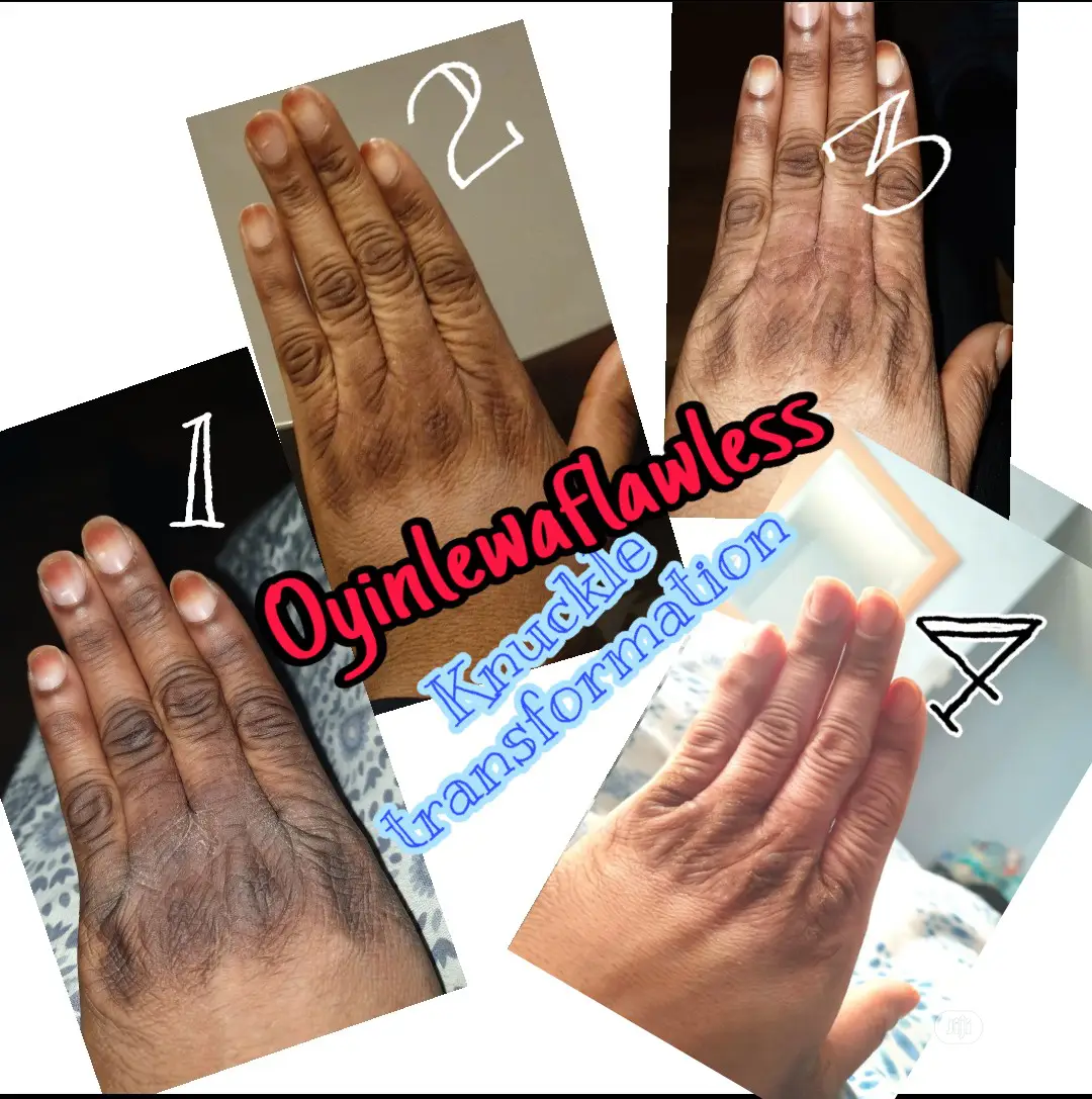 Diploma In Online Skincare Course