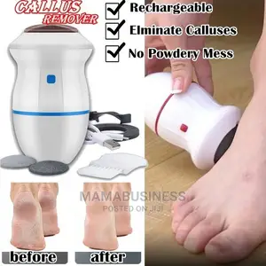 Find Back Callus Remover With Built-in Vacuum