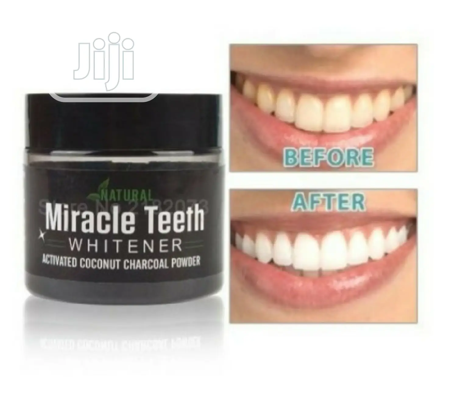 Miracle Teeth Whitener