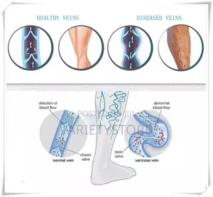 Medical Compression Socks Varicose Veins Socks