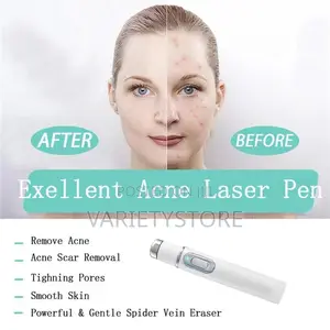 Blue Light Therapy Laser Pen Spider Vein Acne Removal Tool