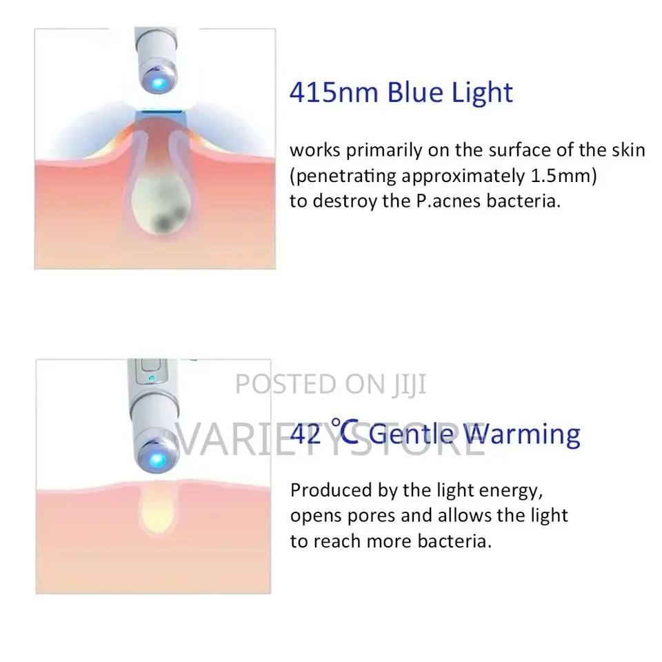 Blue Light Therapy Laser Pen Spider Vein Acne Removal Tool