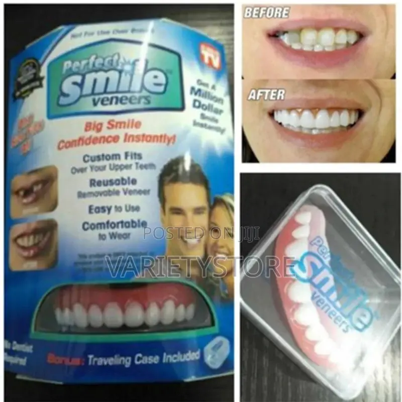 Perfect Smile Teeth Veneers