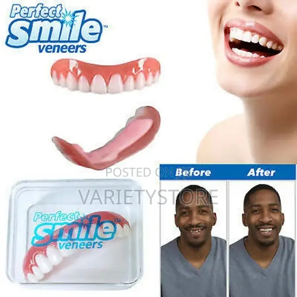 Perfect Smile Teeth Veneers