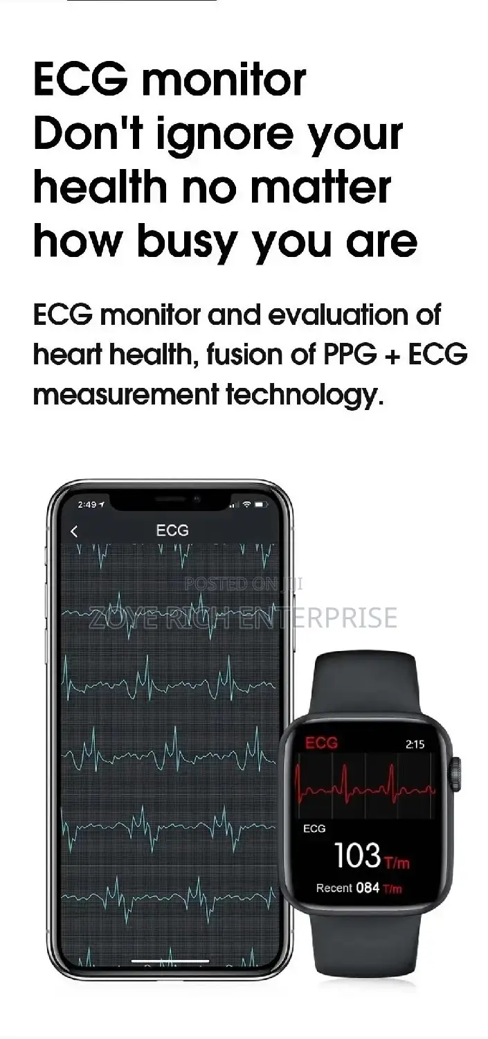 This Is Smart Watch And Fits