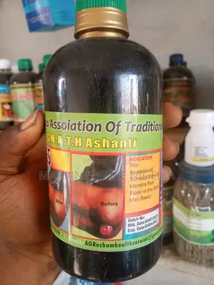 Waris Pile Hemorrhoids Mixture ( Jedi Related Issue )