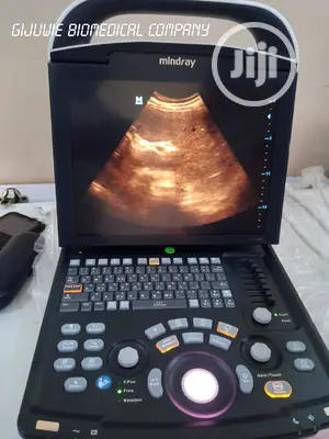 Mindray Dp10 Ultrasound Machine