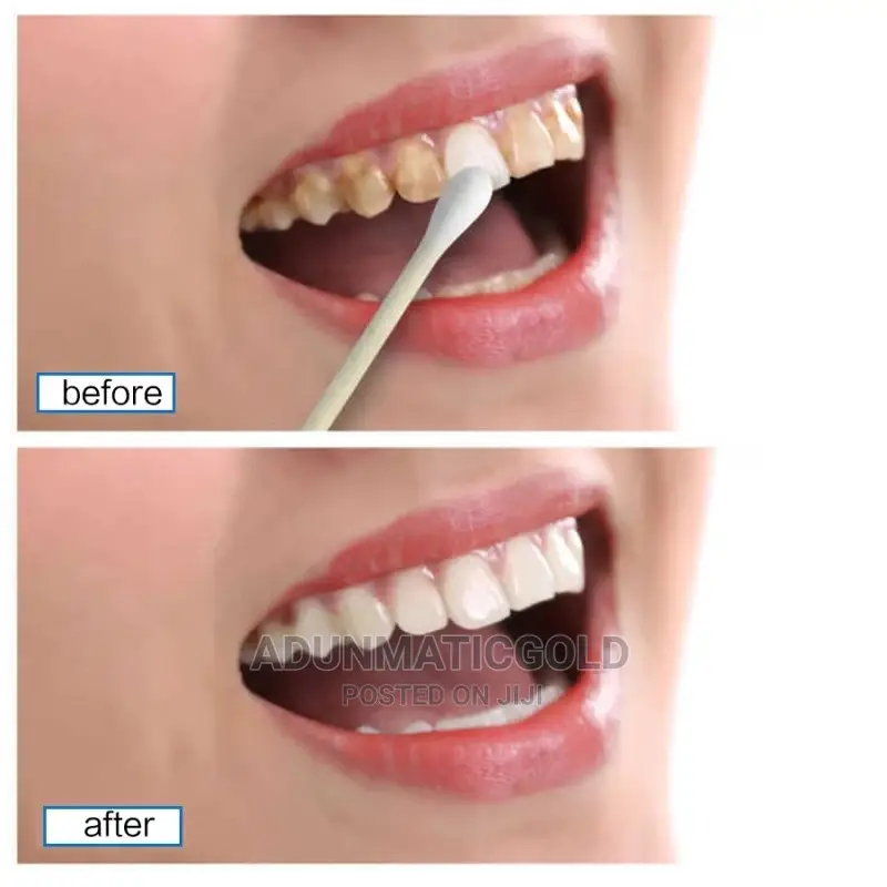 Efero Teeth Whitening Essence