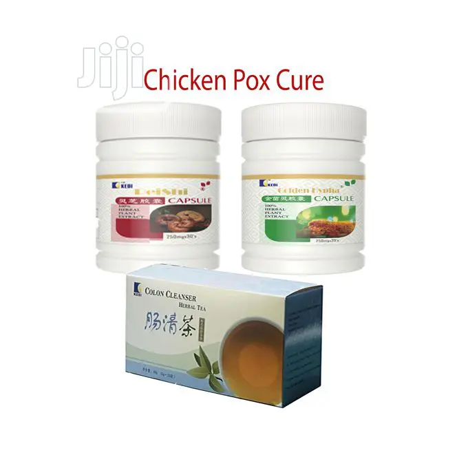 Kedi Chicken Pox Treatment