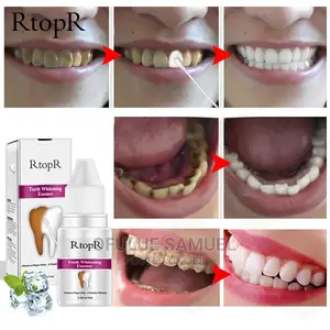 Teeth Whitener