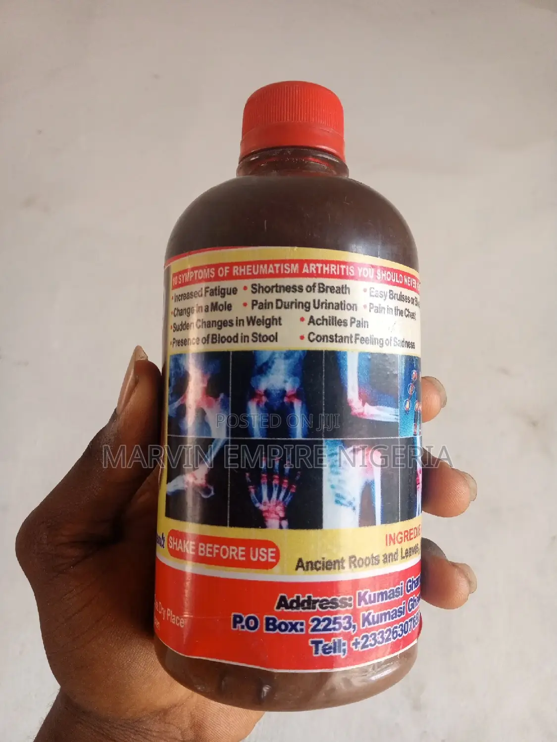 Rheumatism and Arthritis __ Awu - Wo