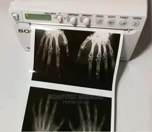 Black and White Ultrasound Thermal Paper