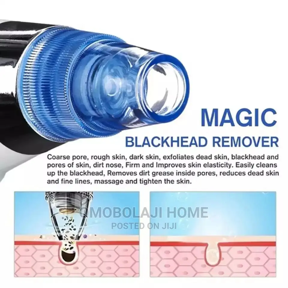 Dermasunction Black Head and Pimples Remover