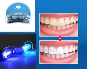 White Light Teeth Whitening