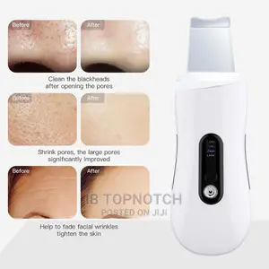 Ultrasonic Skin Scrubber