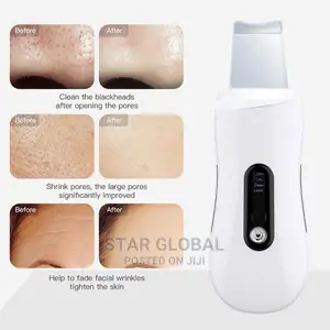 Electric Gentle Ultrasonic Blackhead Skin Scrubber