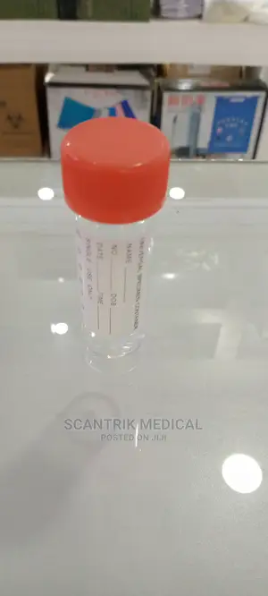 Urine Container With Boric Acid