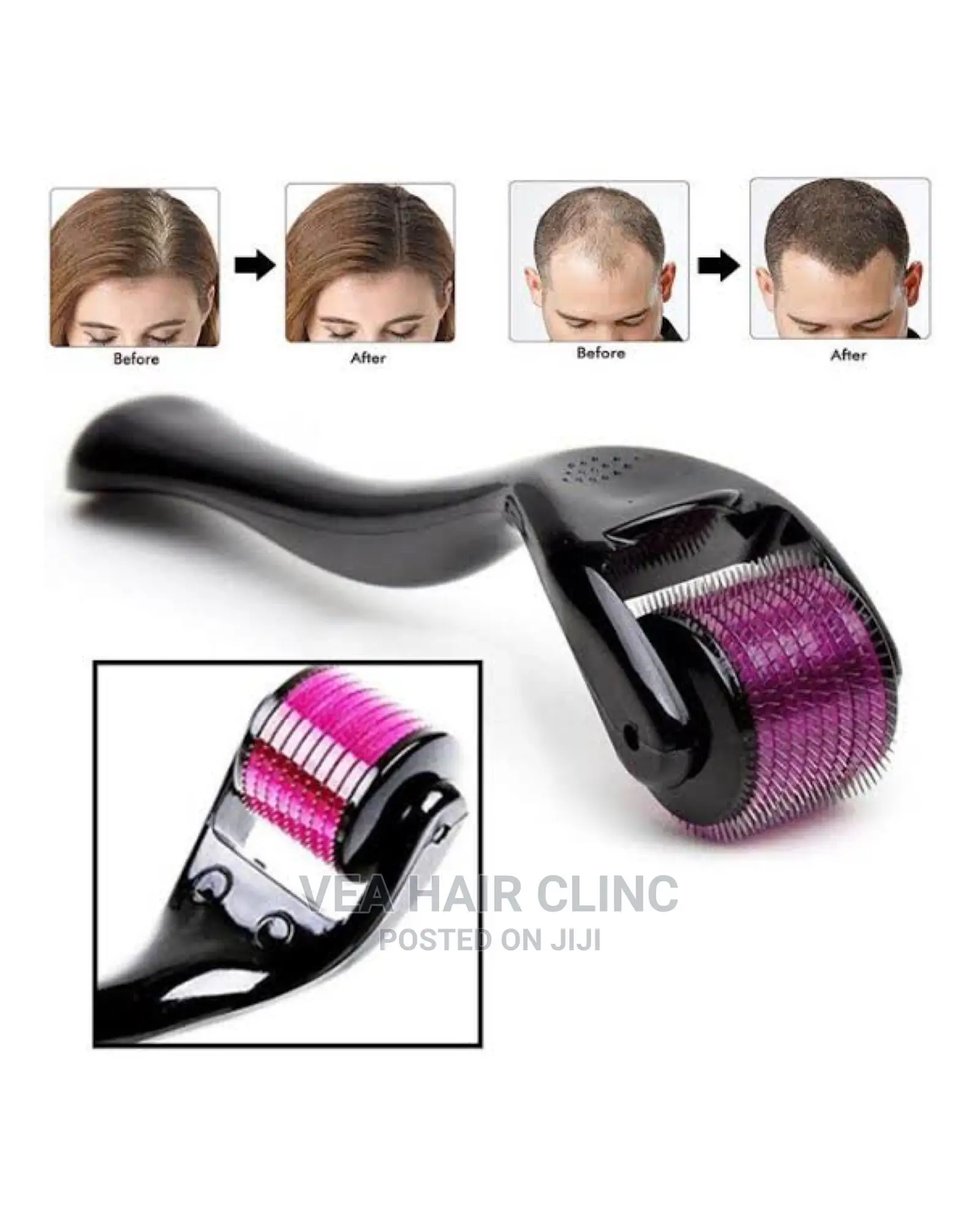 Derma Roller / Derma Stamp
