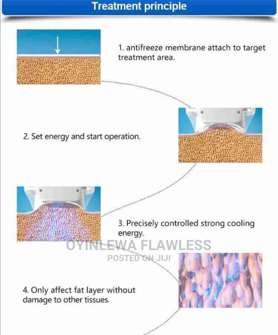 2024 Fat Freezing Machine With 3 Cups