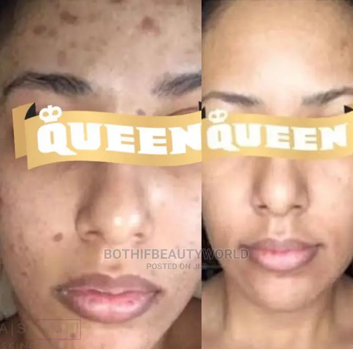 Upgraded Skincare Online Training Pure Safe Promix