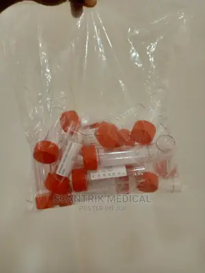 30ml Lab Specimen Containers - Medical Test/Sample Tubes