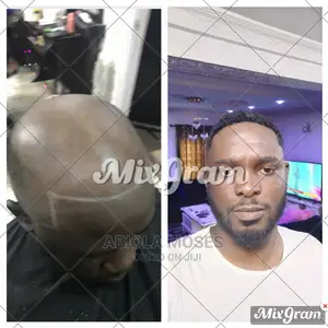 Men Wig Units