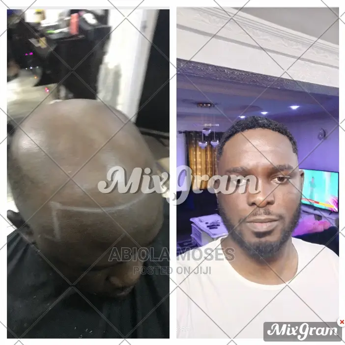 Men Wig Units