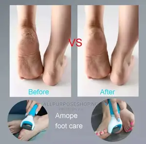 Rechargeable Callous Remover