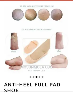 Silicone Pain Relief Slip-On Pads for Crack Feet