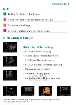 4d Digital Ultrasound Scanning Machine With 3probes