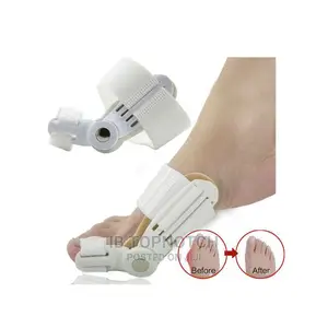 2pcs/Pair Bunion Orthopaedic Brace for Big Toe Correction