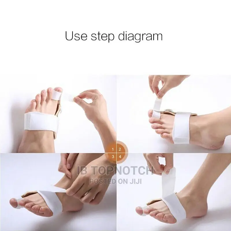 2pcs/Pair Bunion Orthopaedic Brace for Big Toe Correction